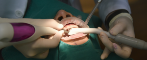 EMC - Esthetic Medical-Dental Corporation - Combate ao Tártaro Dental: Estratégias e Soluções